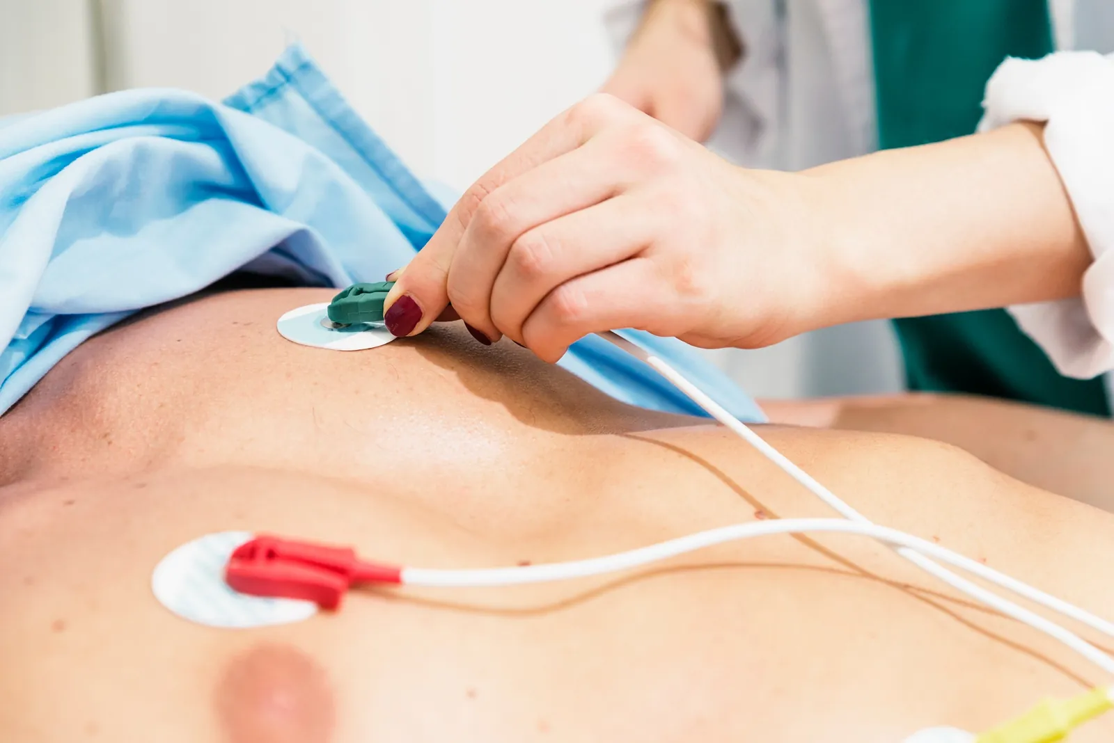 ECG (Electrocardiogram)