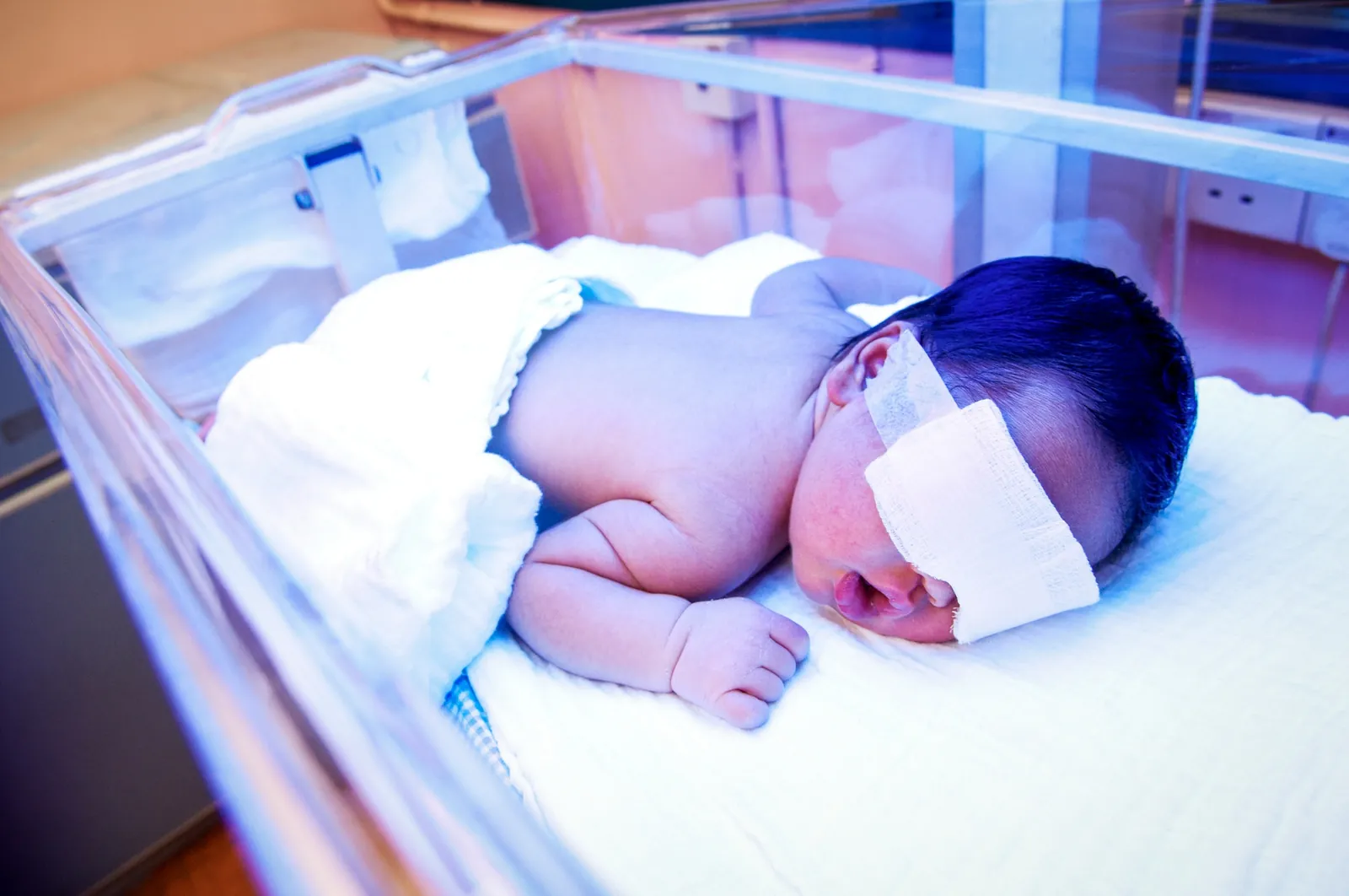 Jaundice